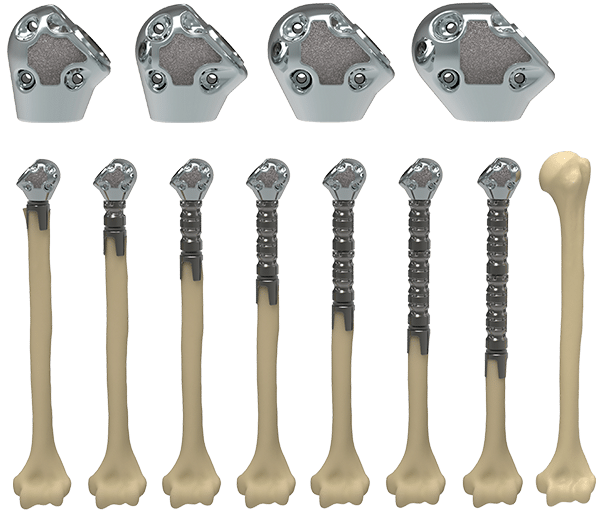 Exactech Equinoxe Shoulder Humeral Reconstruction Prosthesis. Platform stem for hemi, aTSA and rTSA applications.