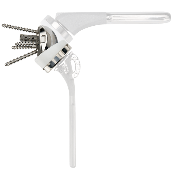 Exactech Equinoxe Shoulder Reverse System. Provides intra-operative flexibility and enables surgeons to convert a well-fixed stem to a reverse without stem removal.