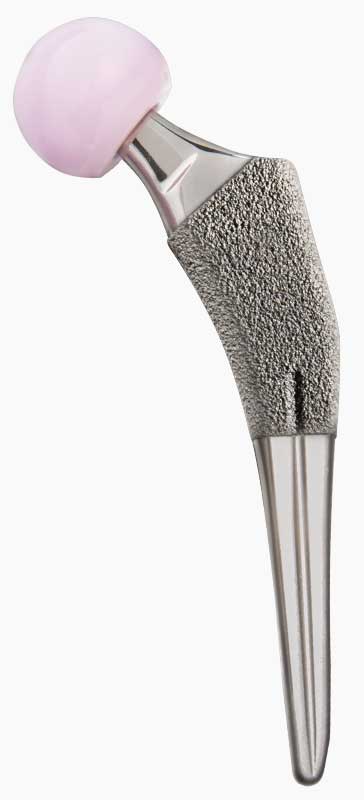 https://www.exac.com/wp-content/uploads/2016/12/web_hip_primary-femoral_alteon-tapered-wedge-stem.jpg