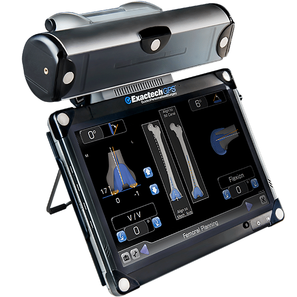Exactech Optetrak Logic CC Revision Knee System and ExactechGPS Knee Application