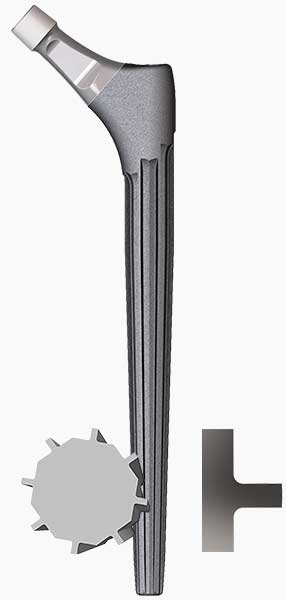 Exactech Alteon Monobloc Revision Femoral Hip Stem. Taper Angle and Spline Design.