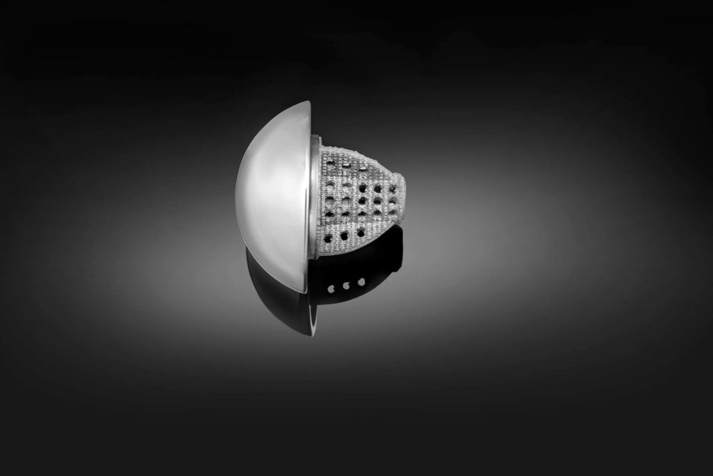 Exactech Equinoxe Shoulder System Stemless Shoulder. A bone conserving prosthesis designed for anatomic total shoulder arthroplasty.