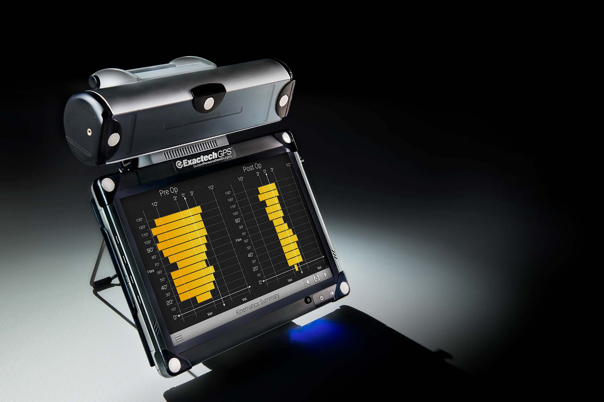 Exactech Provides Powerful Combination of Computer Technology and Award-Winning Instrumentation for Revision Knee Surgery