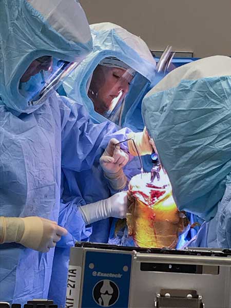 Exactech Truliant Porous Knee Surgery First Cases