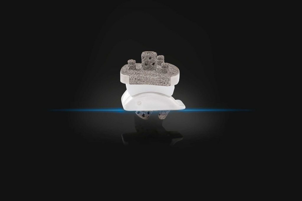 Exactech launches the Vantage Ankle Flat Cut Talus as another ankle replacement option