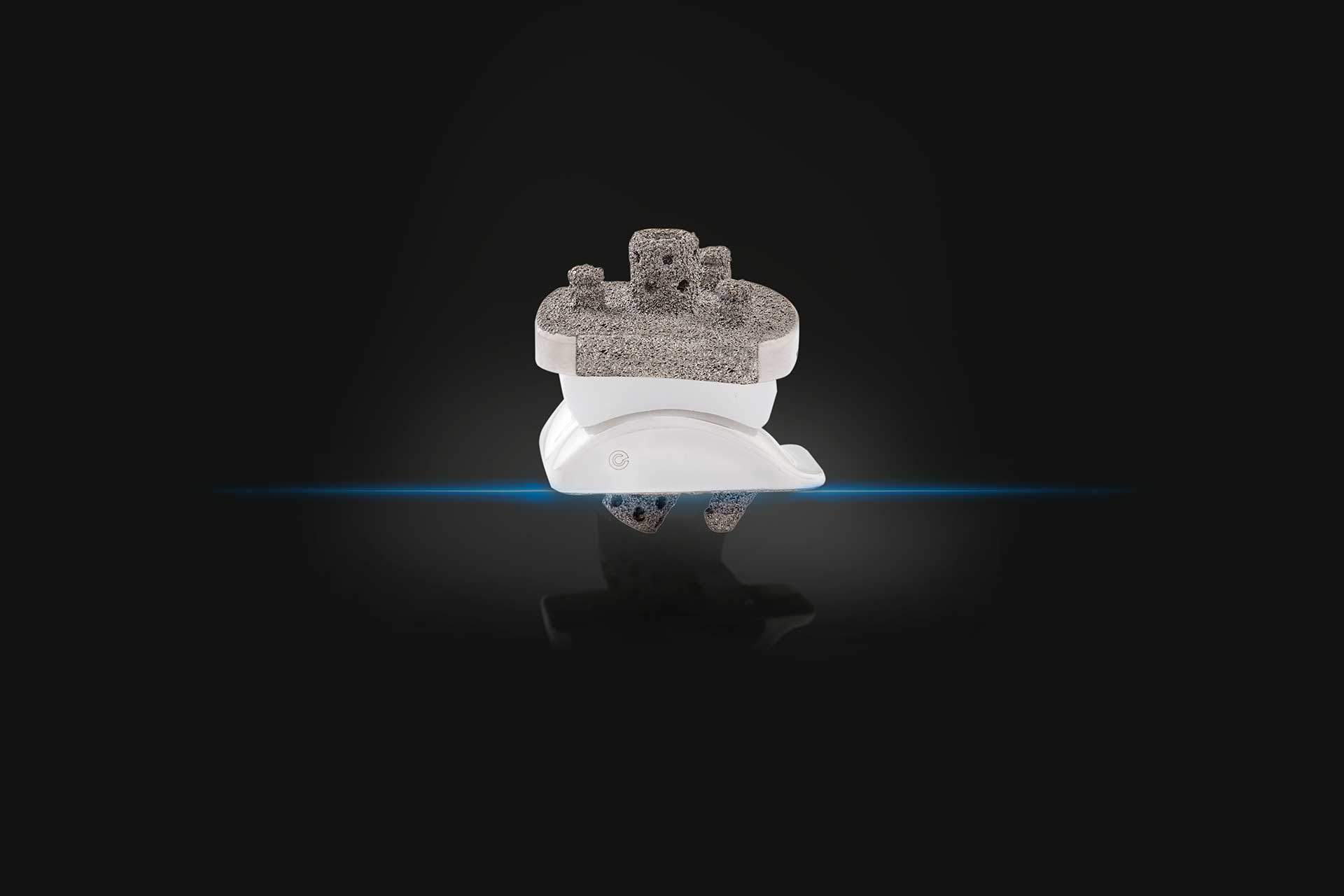 Same Vision, Different Angle with Exactech’s Newest Ankle Implant