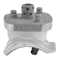 Vantage Ankle Curved Talus