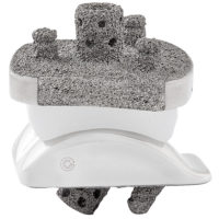 Vantage Ankle Flat Cut Talus