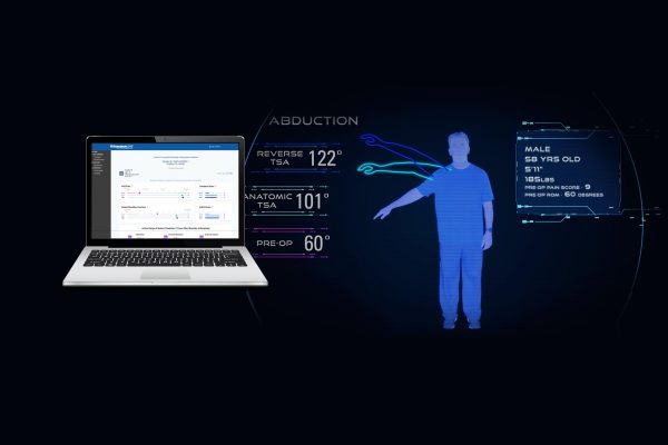 Exactech Predict+ clinical decision support tool