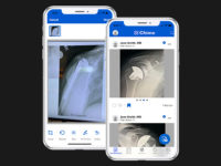 Exactech Chime App for surgeon clinical exchange and case discussions