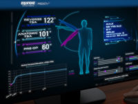 Exactech Predict Plus Data-driven, clinical decision support tool that uses machine learning.