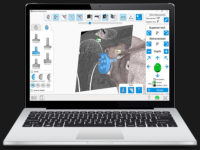 Exactech Shoulder Planning Applications software for reconstruction of the scapula in 3D