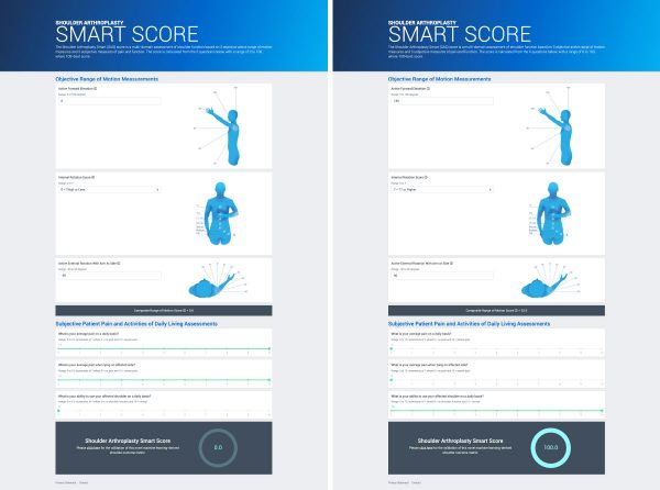 Shoulder Arthroplasty Smart Score