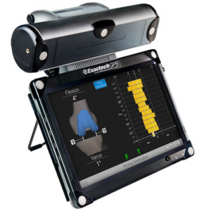 ExactechGPS Knee Replacement Surgery Technology. Exactech Active Intelligence surgeons use a computer-assisted surgical technology called ExactechGPS Guided Personalized Surgery
