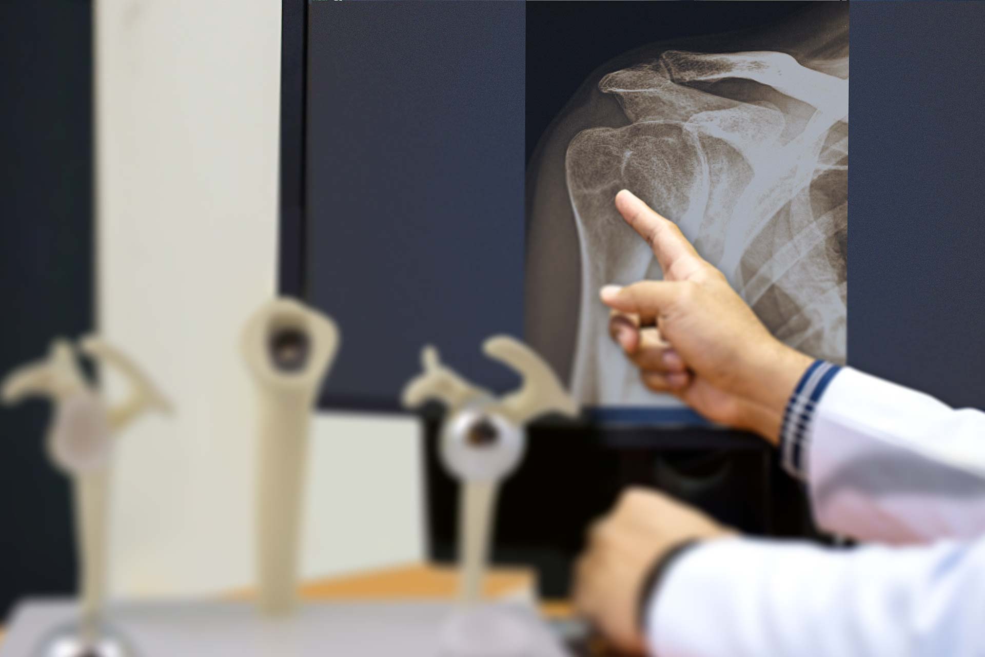 Shoulder Replacement Surgery Surgical Treatment Options Exactech