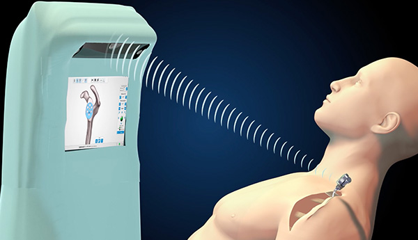 ExactechGPS Shoulder Intraoperative Flexibility