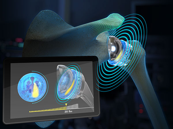 VERASENSE™ wireless humeral sensor and display unit provide