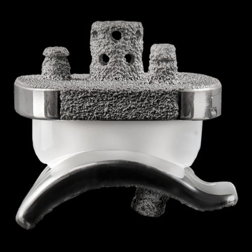Exactech vantage total ankle