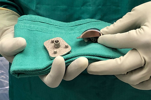 Vantage Total Ankle Flat Cut Talus Implants
