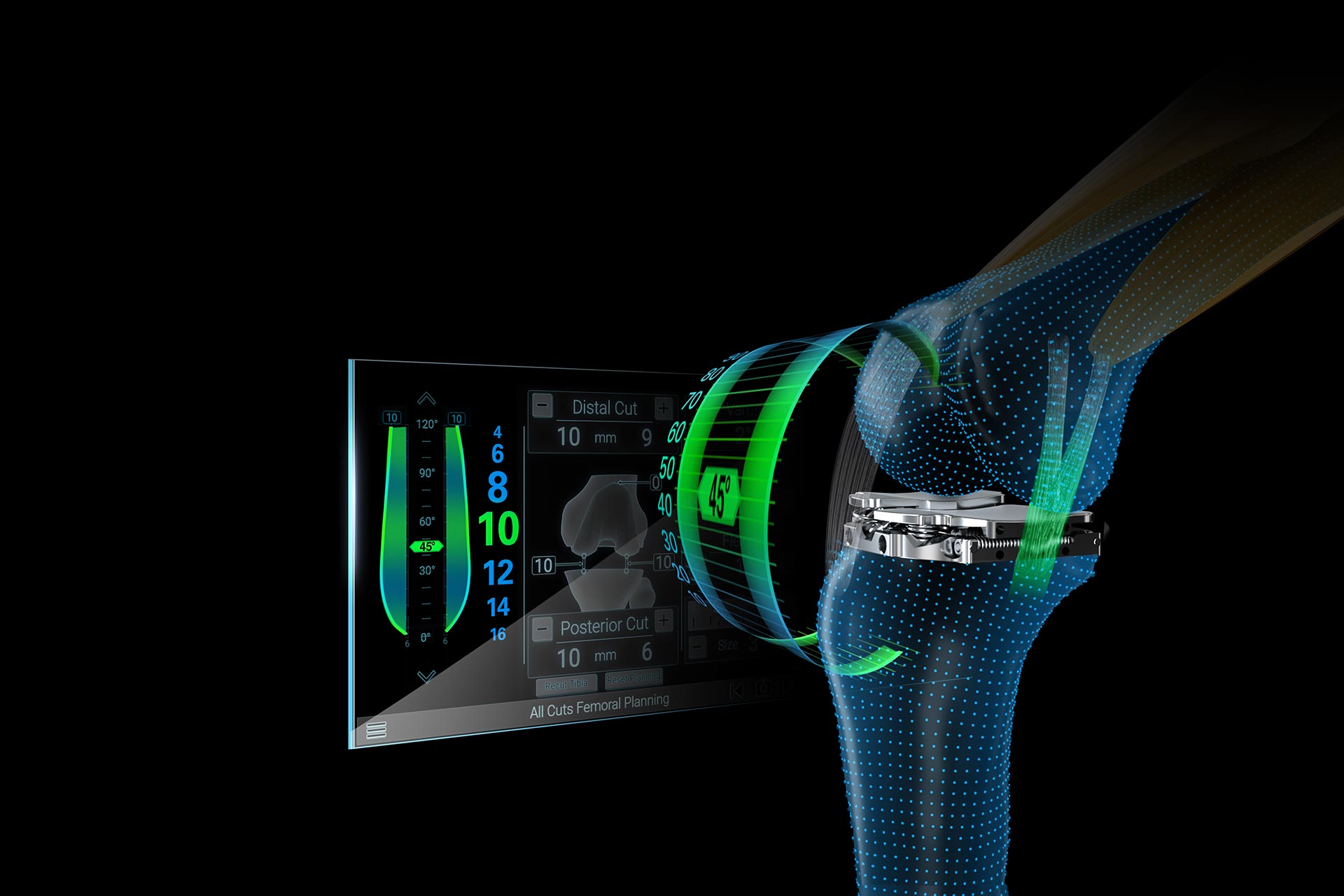 Newton Dynamic Knee Soft Tissue Management Technology