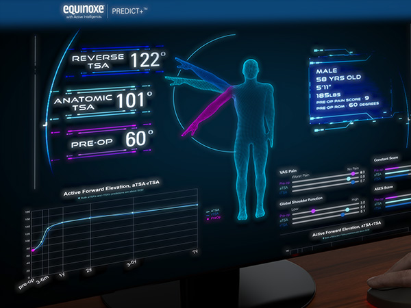 Exactech Predict Plus Data-driven, clinical decision support tool that uses machine learning.