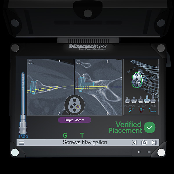 ExactechGPS Shoulder Application