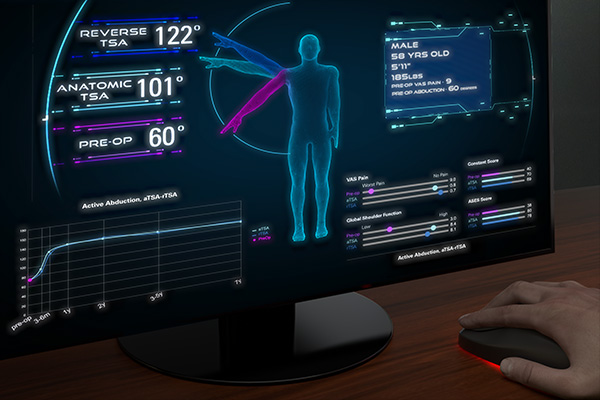 Predict+ clinical decision support tool