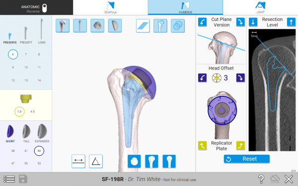 The Equinoxe Planning App (v.2.0) allows for planning of humeral head offsets and replicator plate positioning.