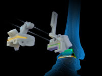 Vantage Ankle PSI