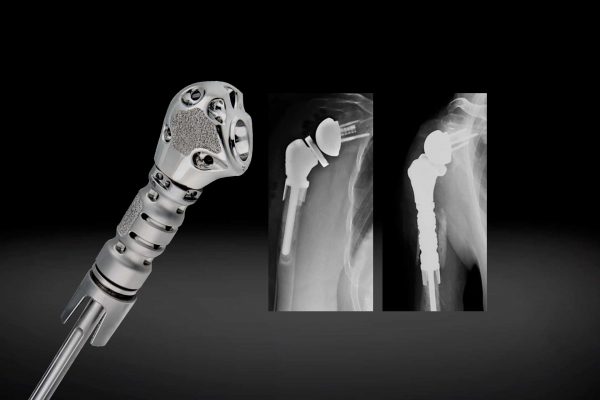 Equinoxe® Humeral Reconstruction Prosthesis 