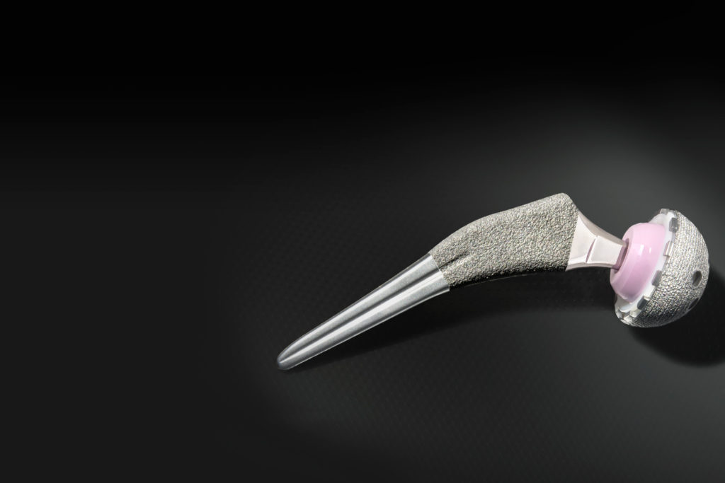 Alteon Tapered Wedge Stem Total Hip Arthroplasty Exactech