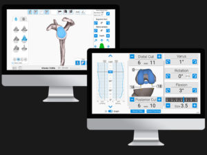 ExactechGPS Surgical reports