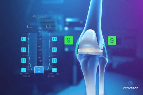 Exactech Newton Knee