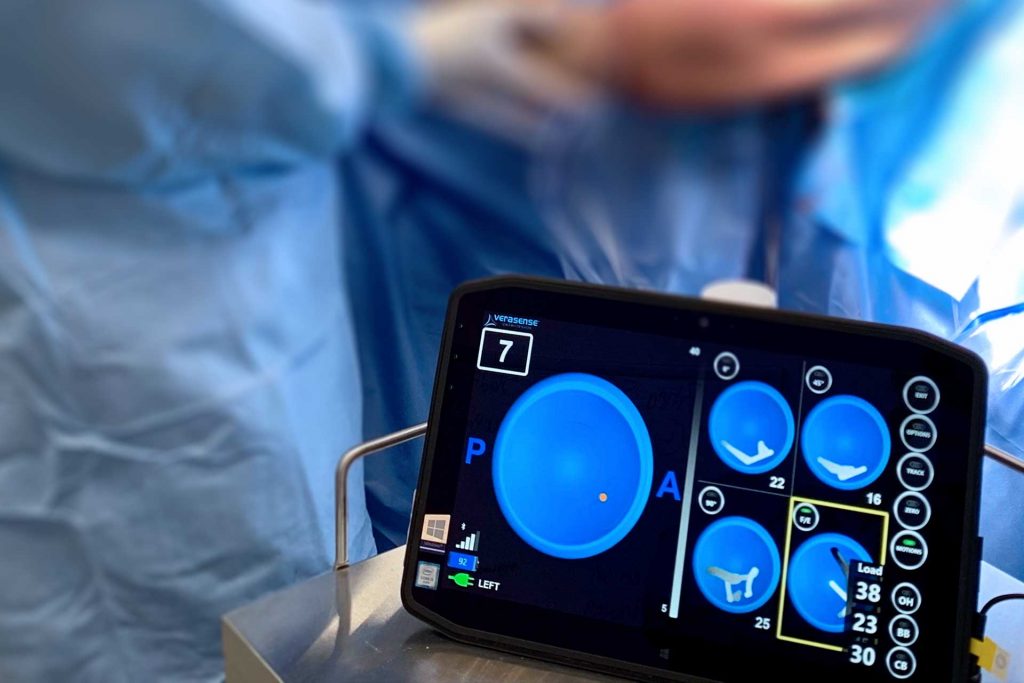 Exactech Technology for rTSA