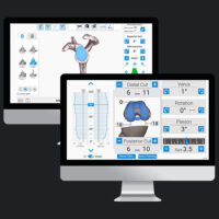 ExactechGPS Surgical Reports