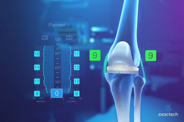 Exactech Newton Knee Ligament Balancing