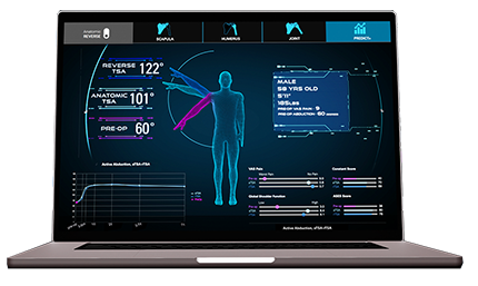 Predict+ is a Data-driven, clinical decision support tool that uses machine learning to provide predictions of individual patient outcomes after surgery.