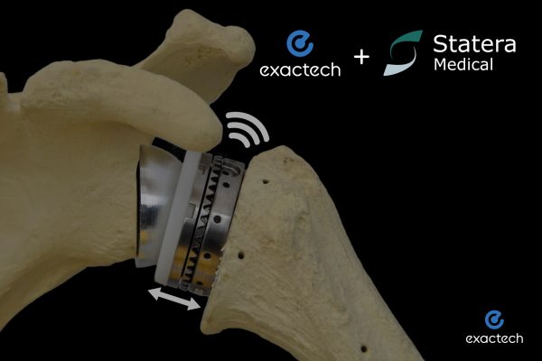 Exactech Partners with Statera Medical to Co-Develop World’s First Smart Reverse Shoulder Implant