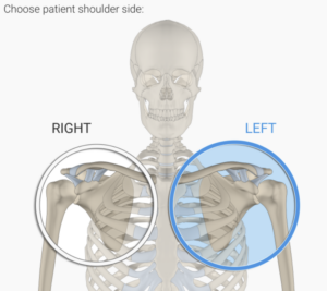 Exactech AI One Active Intelligence Surgeon and Rep Portal CT Scan with Left side selected