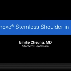 : Total shoulder arthroplasty, Stemless, anatomic