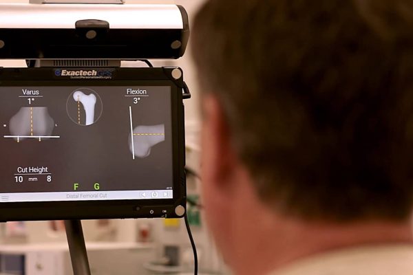 Truliant-Knee-System-Surgeon-ExactechGPS