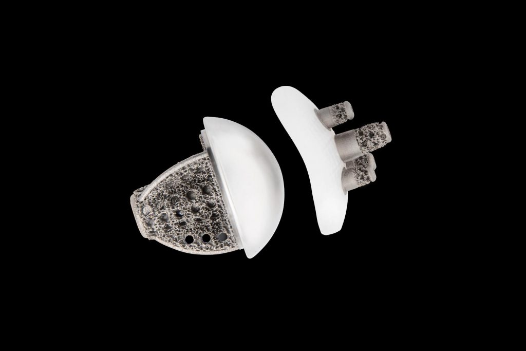 Exactech Equinoxe Shoulder Stemless