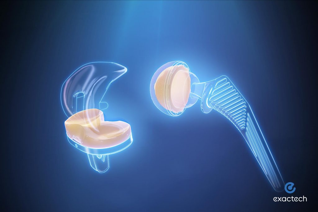 Exactech Vitamin E Polyethylene Technology for Hip and Knee Replacement
