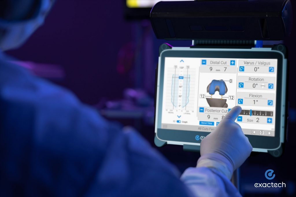 Exactech Knee with GPS Active Intelligence Technology