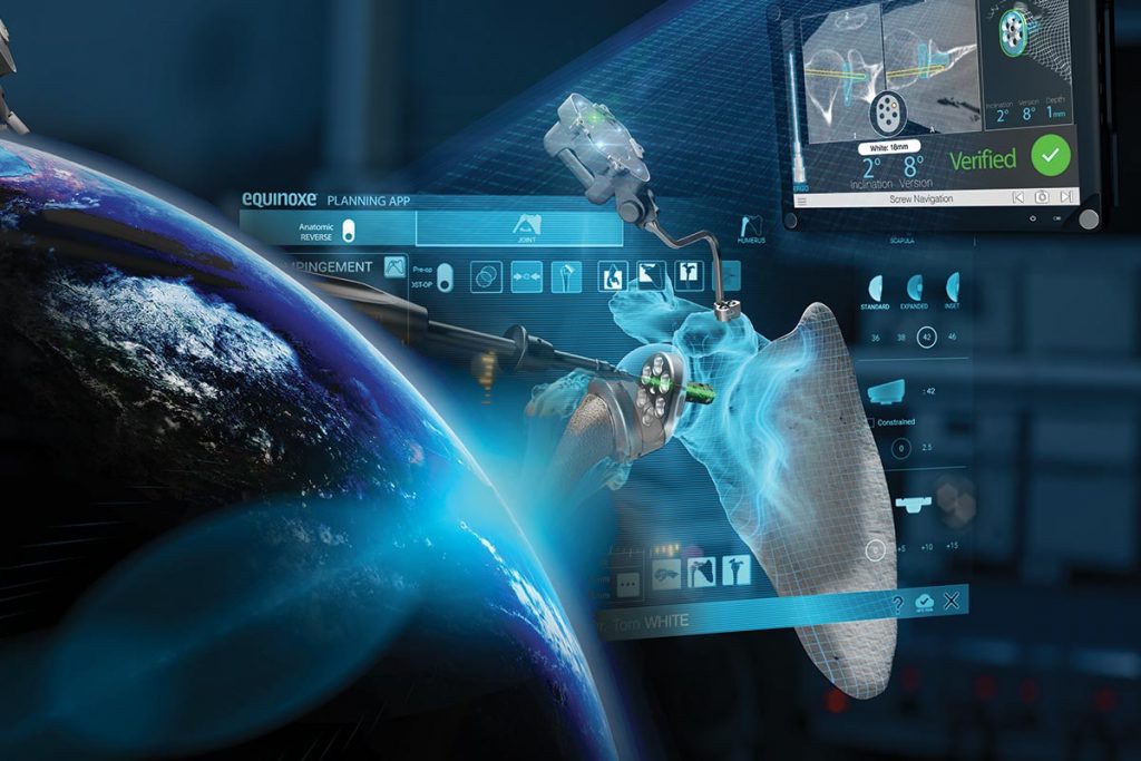 GPS Shoulder gains momentum globally