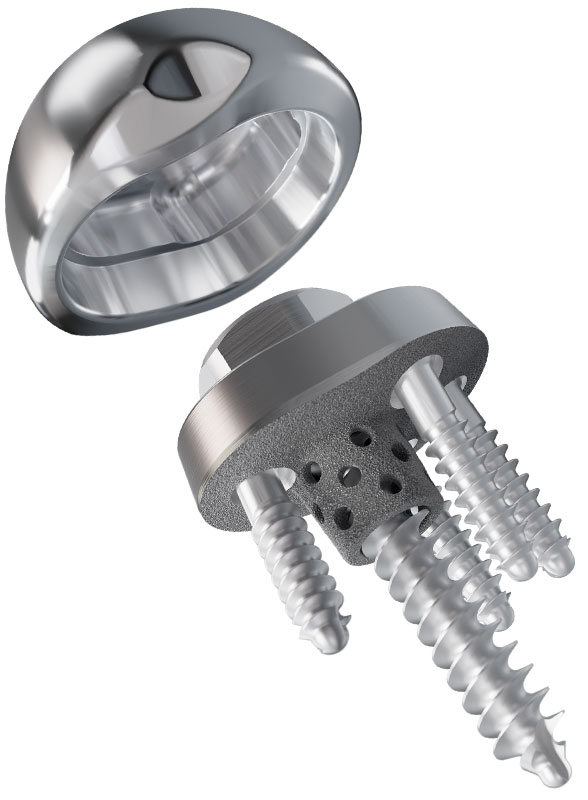 Equinoxe Shoulder Central Screw Baseplate